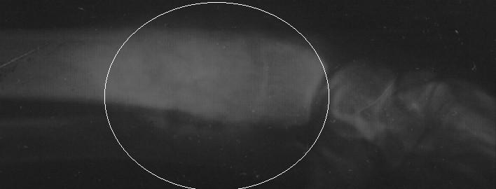 Kirah Xray 2